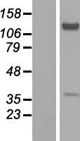 EXTL2 Human Over-expression Lysates NM_001033025