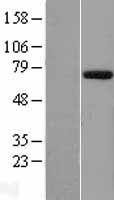EYA1 Human Over-expression Lysates NM_000503