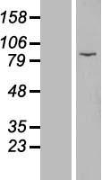 EZH1 Human Over-expression Lysates NM_001991