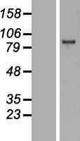 EZH2 Human Over-expression Lysates NM_004456