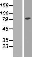 EZH2 Human Over-expression Lysates NM_152998