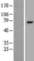 Prothrombin (F2) Human Over-expression Lysates NM_000506