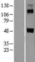 Factor VII (F7) Human Over-expression Lysates NM_019616