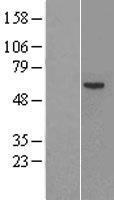 Factor IX (F9) Human Over-expression Lysates NM_000133