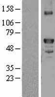 ls002159 factor x f10 human over expression lysates nm 000504 wb testing 1