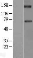 Factor XI (F11) Human Over-expression Lysates NM_000128