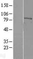 Factor XIIIa (F13A1) Human Over-expression Lysates NM_000129