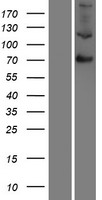 Factor XIII (F13B) Human Over-expression Lysates NM_001994