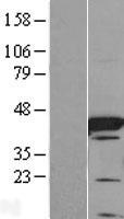 FABP6 Human Over-expression Lysates NM_001445