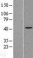 Fumarylacetoacetate hydrolase (FAH) Human Over-expression Lysates NM_000137