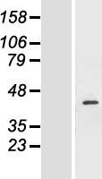 FANCF Human Over-expression Lysates NM_022725
