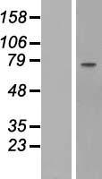 Fibulin 1 (FBLN1) Human Over-expression Lysates NM_006486
