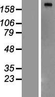 ls002194 fatty acid synthase fasn human over expression lysates nm 004104 wb testing 1