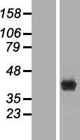 FBP1 Human Over-expression Lysates NM_001127628