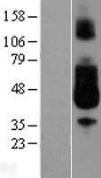 CD89 (FCAR) Human Over-expression Lysates NM_002000
