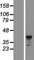 CD89 (FCAR) Human Over-expression Lysates NM_133269