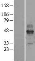 Fc epsilon RI (FCER1A) Human Over-expression Lysates NM_002001