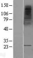 MS4A2 Human Over-expression Lysates NM_000139
