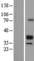 CD23 (FCER2) Human Over-expression Lysates NM_002002