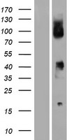 CD64 (FCGR1B) Human Over-expression Lysates NM_001017986