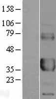 CD32A (FCGR2A) Human Over-expression Lysates NM_021642