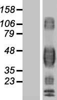 CD32B (FCGR2B) Human Over-expression Lysates NM_001002273
