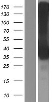 CD32B (FCGR2B) Human Over-expression Lysates NM_001002274