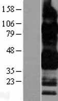 CD32B (FCGR2B) Human Over-expression Lysates NM_001002275