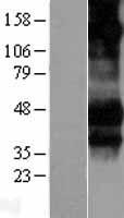 CD16 (FCGR3A) Human Over-expression Lysates NM_000569