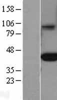 FCGRT Human Over-expression Lysates NM_004107