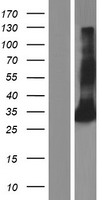 Ficolin 2 (FCN2) Human Over-expression Lysates NM_015837