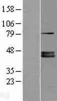 FDPS Human Over-expression Lysates NM_001135821
