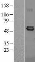 Ferredoxin Reductase (FDXR) Human Over-expression Lysates NM_024417