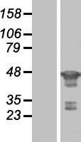 FEN1 Human Over-expression Lysates NM_004111