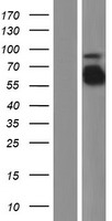 Fibrinogen alpha chain (FGA) Human Over-expression Lysates NM_021871