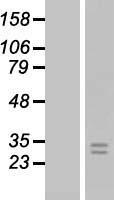FGF8 Human Over-expression Lysates NM_033163