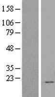 FGF12 Human Over-expression Lysates NM_004113