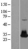 FGF12 Human Over-expression Lysates NM_021032