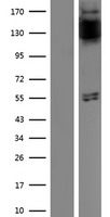 FGFR1 Human Over-expression Lysates NM_015850