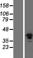 FGFR1 Human Over-expression Lysates NM_023107