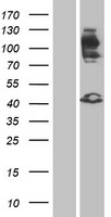 FGFR2 Human Over-expression Lysates NM_022970