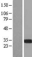 FGL1 Human Over-expression Lysates NM_004467