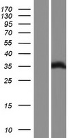 FHL1 Human Over-expression Lysates NM_001159701