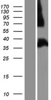 FHL1 Human Over-expression Lysates NM_001159702
