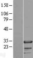 FHL2 Human Over-expression Lysates NM_001450