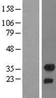 FHL2 Human Over-expression Lysates NM_201555