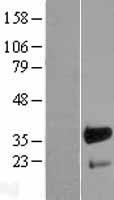 FHL3 Human Over-expression Lysates NM_004468
