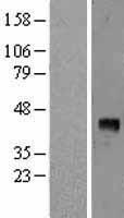 VEGFD Human Over-expression Lysates NM_004469
