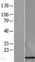 FKBP12 (FKBP1A) Human Over-expression Lysates NM_000801
