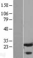 FKBP25 (FKBP3) Human Over-expression Lysates NM_002013